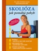 Skolióza (Kolektív autorov)