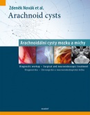 Arachnoidální cysty mozku a míchy (Zdeněk Novák)