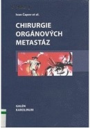 Chirurgie orgánových metastáz (Ivan Čapov)