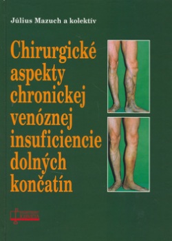 Chirurgické aspekty chronickej venóznej insuficiencie dolných končatín (1. akosť) (Július Mazuch)