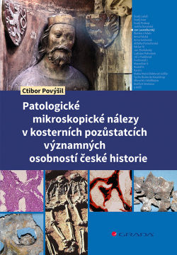 Patologické mikroskopické nálezy v kosterních pozůstatcích významných osobností české historie (Povýšil Ctibor)